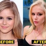 Behind the Scenes: Bunnie XO's Pre-Surgical Reflections and Choices