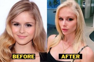 Behind the Scenes: Bunnie XO's Pre-Surgical Reflections and Choices